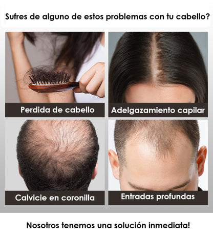 COMBO: Fibras capilares de queratina + Spray Fijador 💈🔥